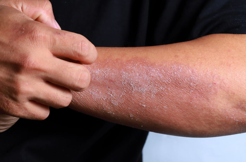 covaris scratching skin